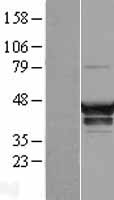 SNX16 Human Over-expression Lysate