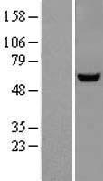 MCCC2 Human Over-expression Lysate