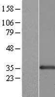 FKSG14 (CENPK) Human Over-expression Lysate