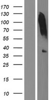 tenomodulin (TNMD) Human Over-expression Lysate