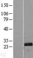 TPK1 Human Over-expression Lysate