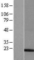 EDDM3B Human Over-expression Lysate
