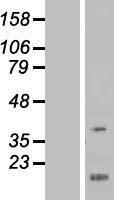 FEZ1 Human Over-expression Lysate
