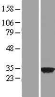 CSN7b (COPS7B) Human Over-expression Lysate
