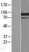 DDX31 Human Over-expression Lysate