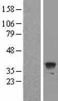 Apg3 (ATG3) Human Over-expression Lysate