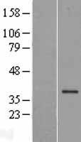 FBXL17 Human Over-expression Lysate