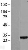 C1orf163 (COA7) Human Over-expression Lysate