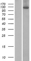 ZSWIM4 Human Over-expression Lysate