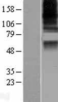 CASD1 Human Over-expression Lysate