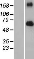 FGFR4 Human Over-expression Lysate