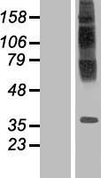 TM6SF1 Human Over-expression Lysate