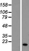 Small EDRK rich factor 1 (SERF1B) Human Over-expression Lysate