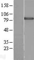 DDX50 Human Over-expression Lysate