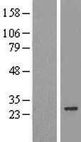 MIS12 Human Over-expression Lysate