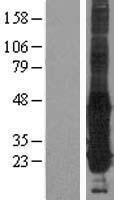 GGCT Human Over-expression Lysate
