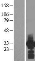 PDCL3 Human Over-expression Lysate