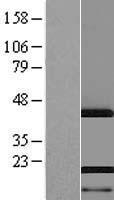 AHNAK Human Over-expression Lysate