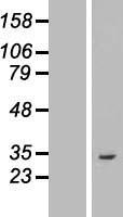 ASB8 Human Over-expression Lysate