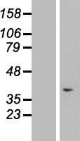 TAF1D Human Over-expression Lysate