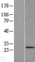 TRIM48 Human Over-expression Lysate