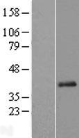 C11orf49 Human Over-expression Lysate