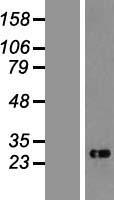 CHAC1 Human Over-expression Lysate