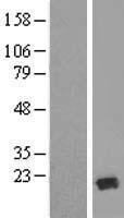 TRAPPC6A Human Over-expression Lysate