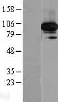 BRME1 Human Over-expression Lysate