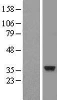 CENPO Human Over-expression Lysate