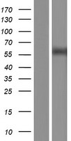 Wilms Tumor Protein (WT1) Human Over-expression Lysate