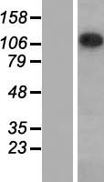SAP130 Human Over-expression Lysate