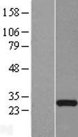 C22orf46 Human Over-expression Lysate