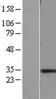 CHMP6 Human Over-expression Lysate
