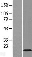 Gemin 7 (GEMIN7) Human Over-expression Lysate