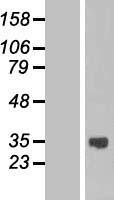 ASB13 Human Over-expression Lysate