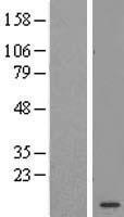 C11ORF67 (AAMDC) Human Over-expression Lysate