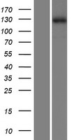 ZMYM1 Human Over-expression Lysate
