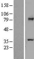 TCTN2 Human Over-expression Lysate