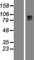 JHY Human Over-expression Lysate