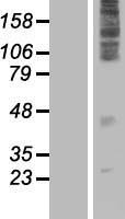 TLCD3A Human Over-expression Lysate