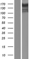 CSPP1 Human Over-expression Lysate