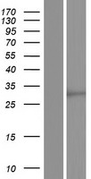SCD5 Human Over-expression Lysate