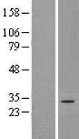 DNAJC22 Human Over-expression Lysate