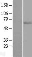 PHF17 (JADE1) Human Over-expression Lysate