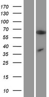 MCPIP1 (ZC3H12A) Human Over-expression Lysate