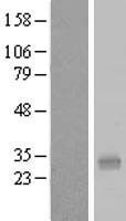 SLC66A2 Human Over-expression Lysate