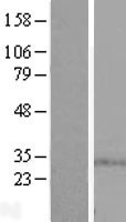 SPSB1 Human Over-expression Lysate