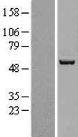 ACSF2 Human Over-expression Lysate
