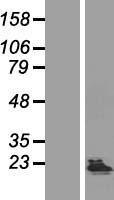 KHDC1 Human Over-expression Lysate